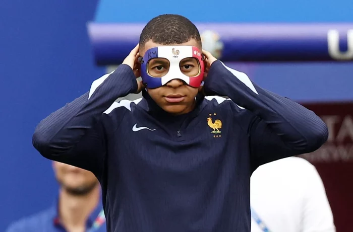 Sự Cố Của Kylian Mbappé Phải Mang Mặt Nạ